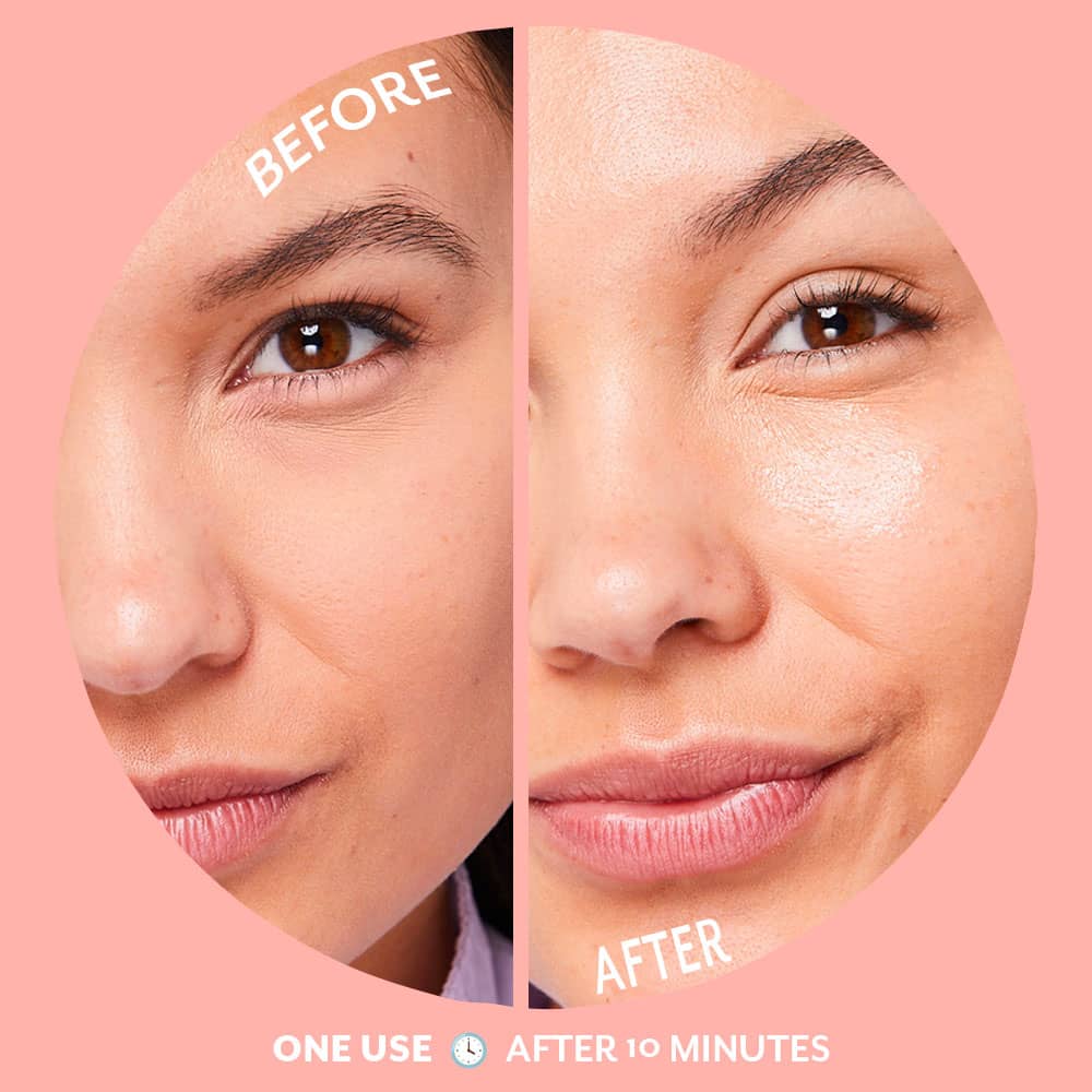 Serve Chilled Bubbly Hydrogel Mask
